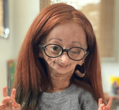 Adalia Rose